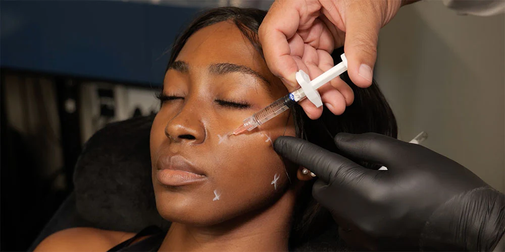 Profhilo in London – The Injectable Glow That’s Changing Skin Care