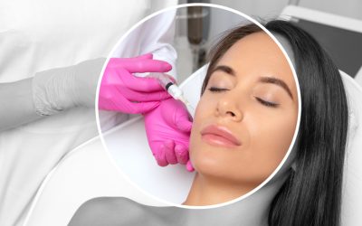 Platelet Rich Plasma for Face Rejuvenation in London and Surrey: The Levitas Advantage