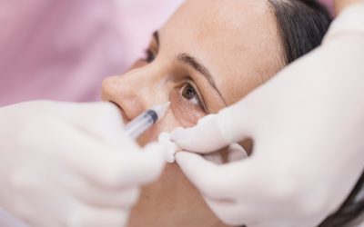 Natural Wrinkle Treatments – Discover PRP, Polynucleotides & Carboxytherapy in London