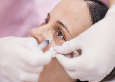 Natural Wrinkle Treatments – Discover PRP, Polynucleotides & Carboxytherapy in London