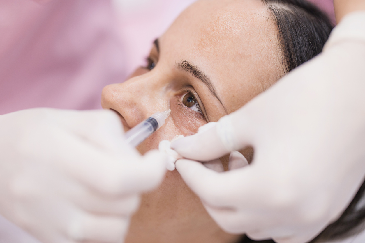 Natural Wrinkle Treatments – Discover PRP, Polynucleotides & Carboxytherapy in London