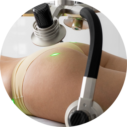 Vaser Lipo (1)